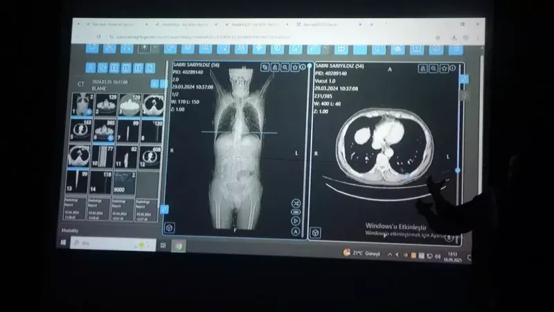 Türkiye’de kanser tedavisinde yapay zeka dönemi